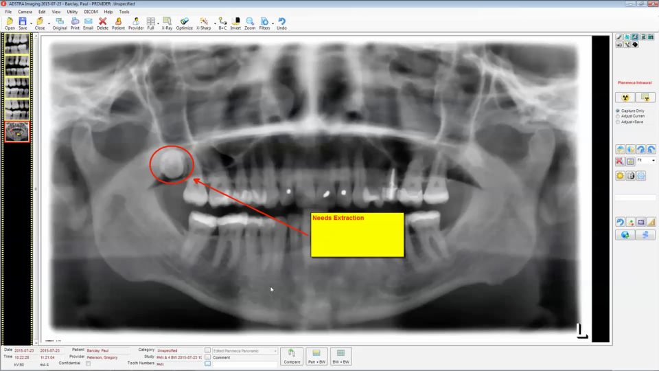 ADSTRA Dental Software Suite-pantalla-2 ADSTRA Dental Software Suite-pantalla-2